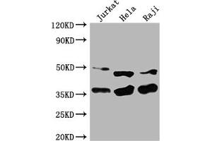 Western Blot Positive WB detected in: Jurkat whole cell lysate, Hela whole cell lysate, Raji whole cell lysate All lanes: NFKBIA antibody at 1:2000 Secondary Goat polyclonal to rabbit IgG at 1/50000 dilution Predicted band size: 36 kDa Observed band size: 36 kDa (NFKBIA antibody  (AA 27-317))