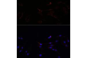 Immunofluorescence analysis of C6 cells using SUCLG1 antibody (ABIN7270623) at dilution of 1:100. (SUCLG1 antibody  (AA 41-346))