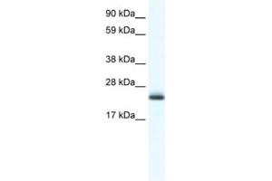 Western Blotting (WB) image for anti-Tubulin Polymerization Promoting Protein (Tppp) antibody (ABIN2461555)