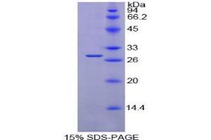 SDS-PAGE analysis of Mouse PDIA2 Protein.