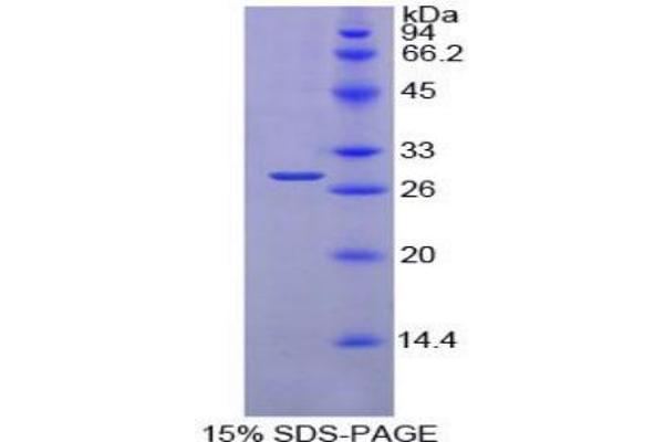PDIA2 蛋白