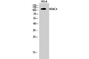 Western Blot analysis of Hela cells using HDAC4 Polyclonal Antibody at dilution of 1:2000. (HDAC4 antibody)