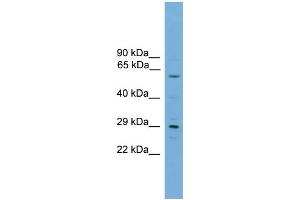 WB Suggested Anti-RPAIN  Antibody Titration: 0.