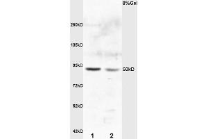 L1 rat kideny lysates L2 rat brain lysates probed with Anti E2F8 Polyclonal Antibody, Unconjugated (ABIN706106) at 1:200 overnight at 4 °C. (E2F8 antibody)