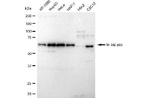 Western blotting analysis using NF-kB p65 antibody (ABIN7799645). (Recombinant NF-kB p65 antibody)