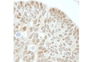 Immunohistochemistry (IHC) image for anti-Drosha, Ribonuclease Type III (DROSHA) (AA 1050-1100) antibody (ABIN7448535)