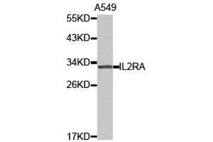 Western Blotting (WB) image for anti-Interleukin 2 Receptor, alpha (IL2RA) antibody (ABIN1873210) (CD25 antibody)
