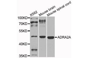 Western blot analysis of extracts of various cells, using ADRA2A antibody. (ADRA2A antibody)