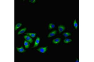 Immunofluorescent analysis of A549 cells using ABIN7167601 at dilution of 1:100 and Alexa Fluor 488-congugated AffiniPure Goat Anti-Rabbit IgG(H+L) (RGS2 antibody  (AA 1-211))