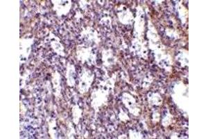 Immunohistochemistry (IHC) image for anti-Interleukin 32 (IL32) (C-Term) antibody (ABIN1030437) (IL32 antibody  (C-Term))