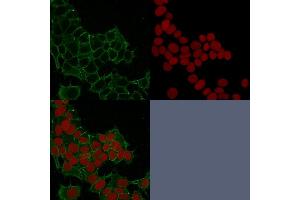 Confocal immunofluorescence image of HeLa cells using Catenin, gamma Mouse Monoclonal Antibody (11E4) Green (CF488) and Reddot is used to label the nuclei Red. (JUP antibody)