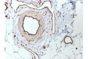 Formalin-fixed, paraffin-embedded human skin stained with CD31 Mouse Monoclonal Antibody (PECAM1/3530). (CD31 antibody  (AA 625-738))