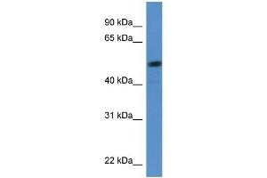 Human HeLa; WB Suggested Anti-SOX5 Antibody Titration: 0. (SOX5 antibody  (C-Term))