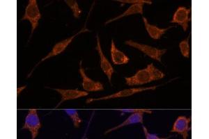 Immunofluorescence analysis of L929 cells using RPE Polyclonal Antibody at dilution of 1:100 (40x lens). (RPE antibody)