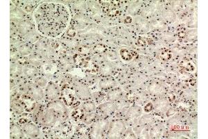 Immunohistochemistry (IHC) image for anti-WD Repeat Domain 83 (wdr83) (Internal Region) antibody (ABIN6281359)