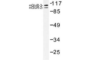 Image no. 1 for anti-Glutamate Receptor, Ionotropic, AMPA 2/3 (GRIA2/3) antibody (ABIN317945) (mGluR2/3 antibody)
