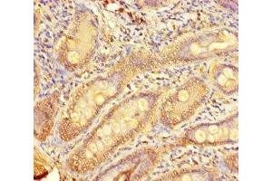 Immunohistochemistry of paraffin-embedded human small intestine tissue using ABIN7173007 at dilution of 1:100 (TMPRSS11D antibody  (AA 201-418))