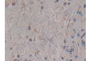 Immunohistochemistry (IHC) image for anti-rho-Associated, Coiled-Coil Containing Protein Kinase 2 (ROCK2) (AA 904-1140) antibody (ABIN7434197)