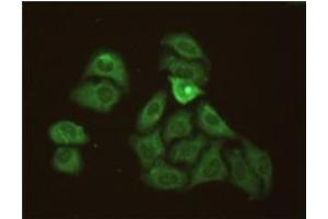 Methanol-fixed Hela cells stained with 10mg/mL anti-Human CRP mAb S5G1 and fluorescence labelled secondary antibody. (CRP antibody)