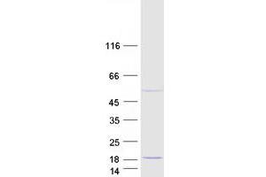 Cysteine-Rich, DPF Motif Domain Containing 1 (CDPF1) protein (Myc-DYKDDDDK Tag)