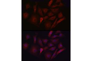 Immunofluorescence analysis of NIH/3T3 cells using LDL Receptor (LDLR) antibody (ABIN7268296) at dilution of 1:50. (LDLR antibody  (C-Term))