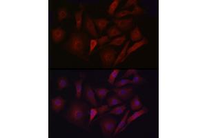 Immunofluorescence analysis of NIH/3T3 cells using LDL Receptor (LDLR) antibody (ABIN7268296) at dilution of 1:50.