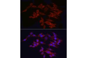 Immunofluorescence analysis of PC-12 cells using WIF1 Rabbit pAb (ABIN6128927, ABIN6150218, ABIN6150220 and ABIN6221033) at dilution of 1:25 (40x lens). (WIF1 antibody  (AA 29-220))