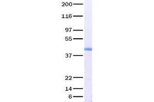 Validation with Western Blot (MMP3 Protein)
