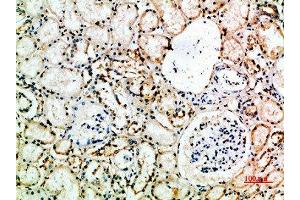 Immunohistochemical analysis of paraffin-embedded human-kidney, antibody was diluted at 1:200 (CD16a, CD16b (AA 100-150) antibody)