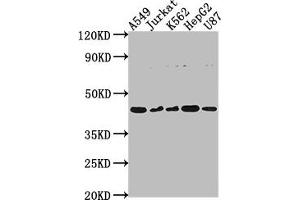 Western Blot Positive WB detected in: A549 whole cell lysate, Jurkat whole cell lysate, K562 whole cell lysate, HepG2 whole cell lysate, U87 whole cell lysate All lanes: DNASE2B antibody at 1:2000 Secondary Goat polyclonal to rabbit IgG at 1/50000 dilution Predicted band size: 42, 18 kDa Observed band size: 42 kDa (DNASE2B antibody  (AA 68-281))