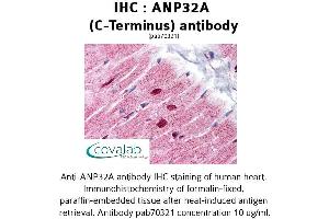 Image no. 1 for anti-Acidic (Leucine-Rich) Nuclear phosphoprotein 32 Family, Member A (ANP32A) antibody (ABIN1731807) (PHAP1 antibody)