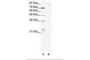 Image no. 1 for anti-Mediterranean Fever (MEFV) (N-Term) antibody (ABIN202912) (MEFV antibody  (N-Term))