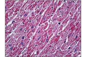 Human Heart: Formalin-Fixed, Paraffin-Embedded (FFPE) (MT-ATP6 antibody  (Subunit alpha))