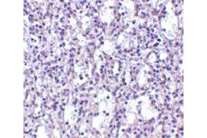 Immunohistochemistry of TBC1D10C in human spleen tissue with TBC1D10C polyclonal antibody  at 2. (Carabin antibody  (N-Term))