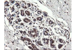 Immunohistochemical staining of paraffin-embedded Human breast tissue using anti-PNPO mouse monoclonal antibody. (PNPO antibody)