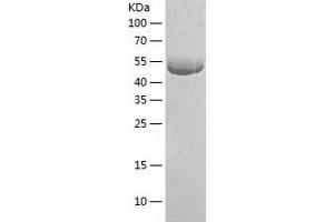 Western Blotting (WB) image for TGF-beta Activated Kinase 1/MAP3K7 Binding Protein 1 (TAB1) (AA 1-504) protein (His tag) (ABIN7287307) (TAB1 Protein (AA 1-504) (His tag))