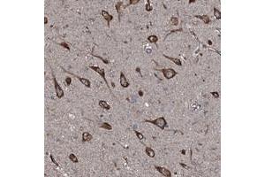 Immunohistochemical staining of human hippocampus with SLC25A38 polyclonal antibody  shows strong cytoplasmic positivity in neuronal cells at 1:50-1:200 dilution. (SLC25A38 antibody)