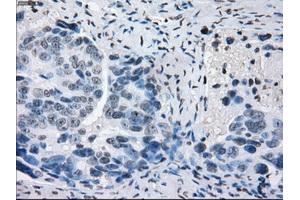 Immunohistochemical staining of paraffin-embedded colon tissue using anti-PRKYmouse monoclonal antibody. (PRKY antibody)