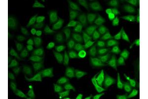 Immunofluorescence analysis of HeLa cells using IMPDH2 antibody (ABIN5973086).
