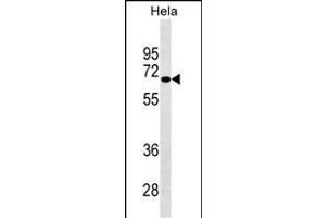 NUAK2 Antibody (ABIN1539841 and ABIN2843822) western blot analysis in Hela cell line lysates (35 μg/lane).