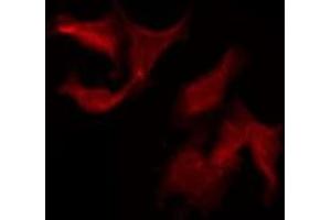 ABIN6275213 staining Hela by IF/ICC. (LRP11 antibody  (Internal Region))