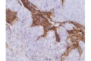 Fig. (CEACAM5 antibody)