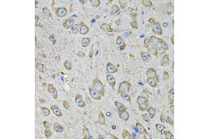 Immunohistochemistry of paraffin-embedded mouse brain using PDIA6 Antibody (ABIN5974243) at dilution of 1/100 (40x lens).