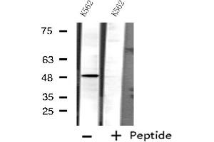 Western blot analysis of extracts from K562 cells, using P450 3A4 antibody.