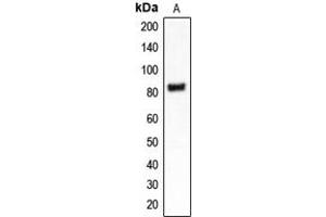 Western blot analysis of CLCN4 expression in MDAMB453 (A) whole cell lysates. (CLCN4 antibody  (Center))