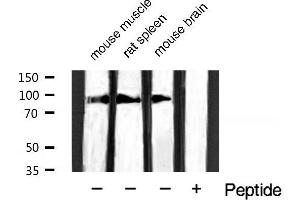 Western blot analysis of extracts of various tissue sample,using Phospho-Catenin-β (Ser37) Antibody. (CTNNB1 antibody  (pSer37))