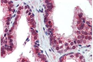 Immunohistochemistry (Paraffin-embedded Sections) (IHC (p)) image for anti-Nuclear Receptor Subfamily 2, Group E, Member 1 (NR2E1) (AA 95-144) antibody (ABIN6741553)
