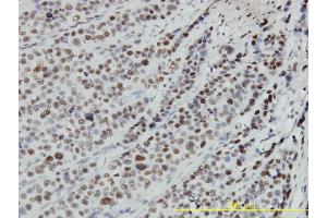 Immunostaining (ISt) image for anti-Retinoblastoma Binding Protein 4 (RBBP4) (AA 1-425) antibody (ABIN562598)