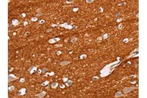 The image on the left is immunohistochemistry of paraffin-embedded Human brain tissue using ABIN7129824(IGSF8 Antibody) at dilution 1/15, on the right is treated with fusion protein. (IGSF8 antibody)