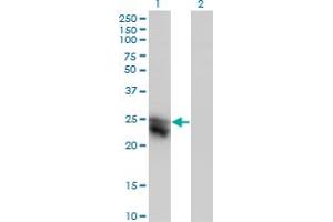 Western Blot analysis of CTHRC1 expression in transfected 293T cell line by CTHRC1 monoclonal antibody (M05), clone 1G12. (CTHRC1 antibody  (AA 32-141))